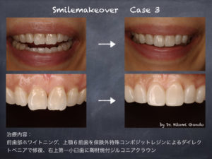 審美歯科治療 | 茗荷谷・大人の矯正歯科・審美歯科 小石川 ひとみ 