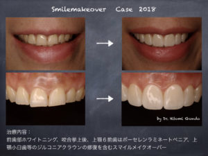 審美歯科治療 | 茗荷谷・大人の矯正歯科・審美歯科 小石川 ひとみ 